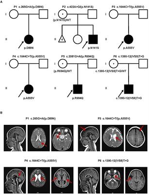 Novel variants in the CLCN4 gene associated with syndromic X-linked intellectual disability